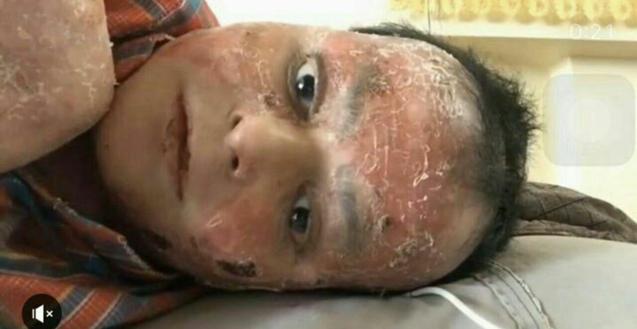 سفیر سلامت مهمان «همیشه خونه» می شود(کودکان پروانه ای)